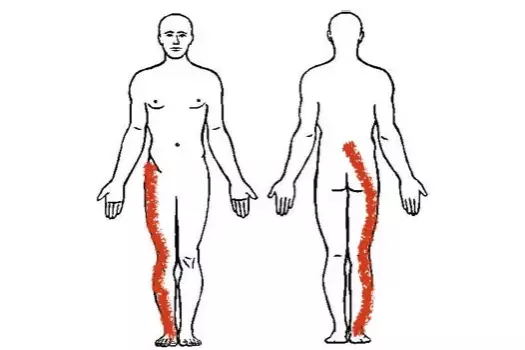 Body map with pain location indicated by a red pen stroke along the right leg